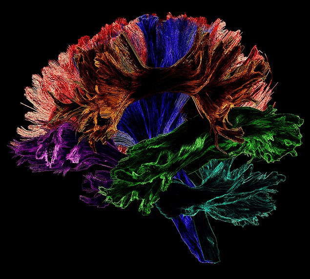 La photo 19 - Mati&egrave;re blanche haute en couleur de Fran&ccedil;ois Rheault, &eacute;tudiant au 3e cycle en informatique dans le cadre du concours La preuve par l'image