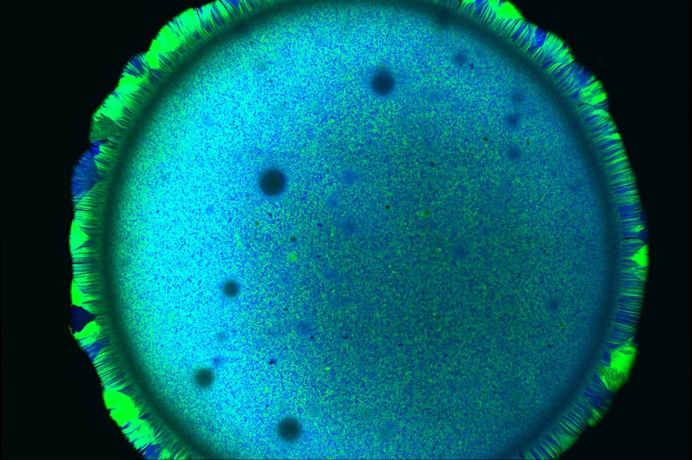 Microplan&egrave;te,&nbsp;de Margot Dessartine, finaliste au concours&nbsp;La preuve par l'image