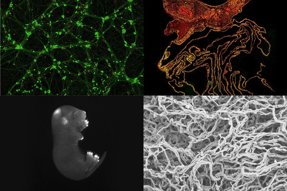 Les quatre images finalistes de l'UdeS aux concours La preuve par l'image et Science Exposed.Photomontage : Michel Caron - UdeS