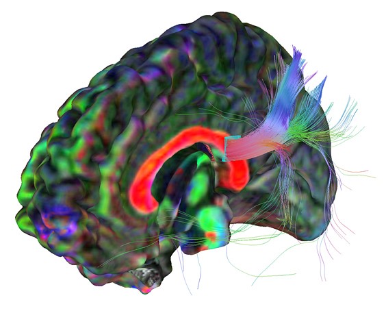 Image d'&Eacute;tienne Saint-Amant, du concours La preuve par l'image, de l'ACFAS