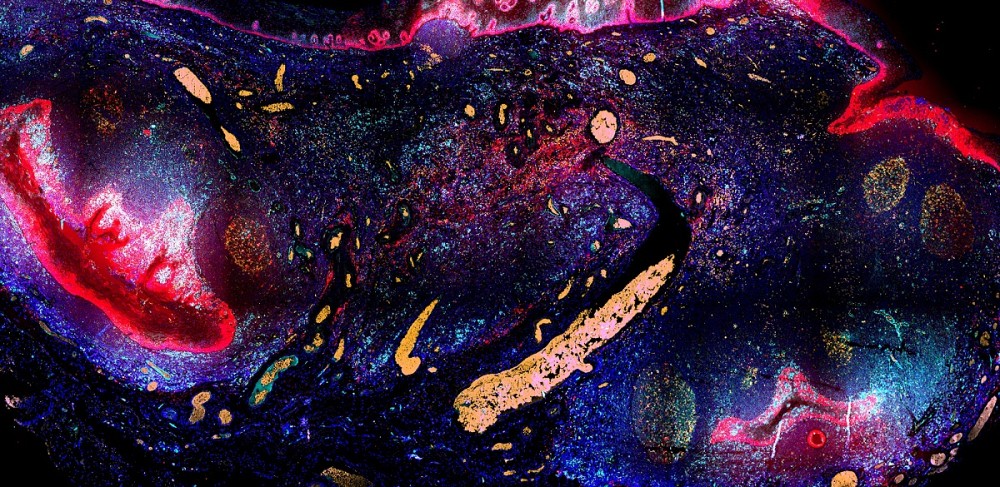 Celia Del Carmen Crespo Oliva, &eacute;tudiante &agrave; la ma&icirc;trise en immunologie, fait partie des finalistes gr&acirc;ce &agrave; son image D&eacute;peindre l'immunit&eacute;.