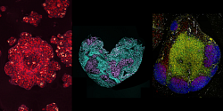 L'art de vaincre le cancer