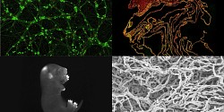 Cerveau, neurones, embryon et champignons : votez pour les images finalistes de l’UdeS