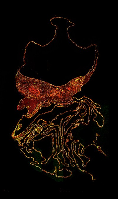 La gardienne flamboyante du cerveau, de L&eacute;a Ferreira. Grossissement : 63x, colorant rouge marquant la pr&eacute;sence d&rsquo;une prot&eacute;ine protectrice (NKCC1), microscopie par fluorescence.