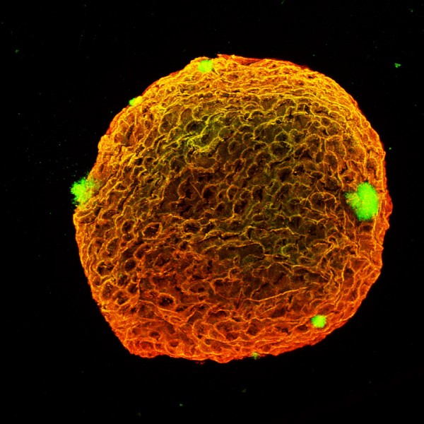 Un vaisseau sp&eacute;cial, par Gilles Grondin. Largeur de la sph&egrave;re&nbsp;: 500&nbsp;milliardi&egrave;mes de m&egrave;tre.