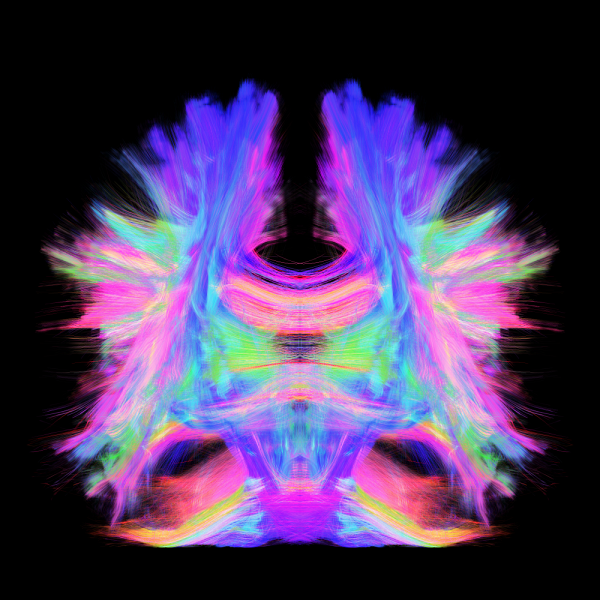 Le financement de la Chaire &eacute;tant renouvel&eacute;, l'&eacute;quipe du Pr&nbsp;Descoteaux pourra continuer d'explorer informatiquement les 160 000 km d'autoroutes de communication qui composent notre cerveau. (Image r&eacute;alis&eacute;e par M. Chamberland, membre de l'&eacute;quipe de recherche)Photo : Fournie