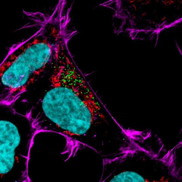 Laurie C&ocirc;t&eacute;, Marilou Boisvert et Samuel G&eacute;nier, &eacute;tudiantes et &eacute;tudiant en pharmacologie &agrave; la Facult&eacute; de m&eacute;decine et sciences de la sant&eacute;, sont&nbsp;finalistes avec leur image&nbsp;Mortelle immortalit&eacute;.