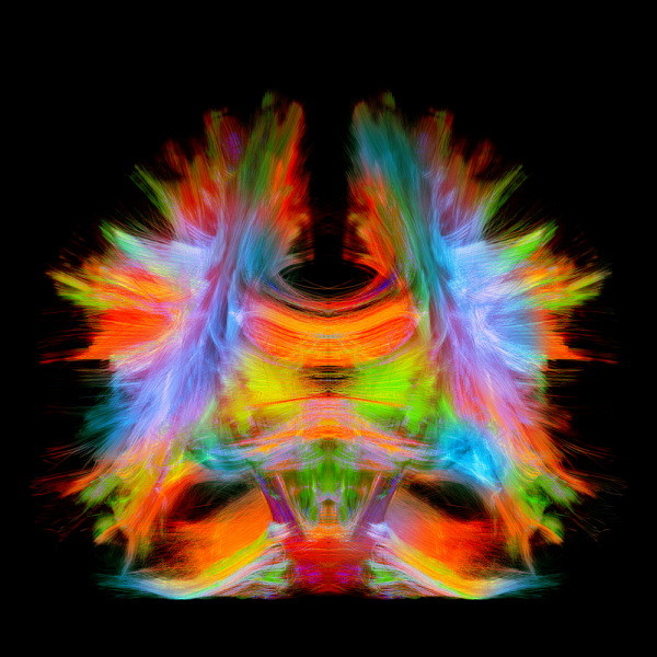 Une image de tractographie