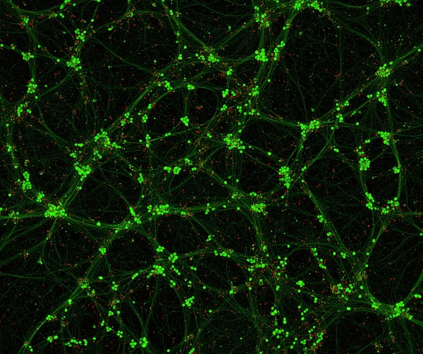 Parlement de neurones, de Gabrielle-Lee Gaudreau. Grossissement : 100x, microscopie par fluorescence.