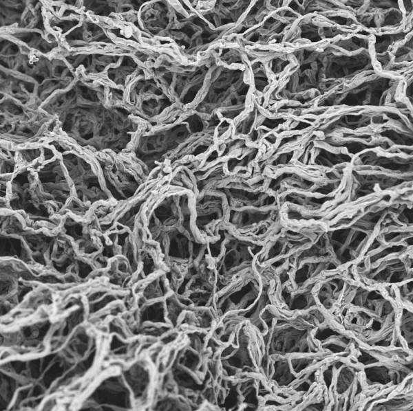 Tissu de champignons, de Rathush Mahalingam, en collaboration avec Ranthosh et Ramshaa Mahalingam, Universit&eacute; Carleton et Universit&eacute; d&rsquo;Otago (N.Z.). Grossissement : 1000x, microscopie &eacute;lectronique &agrave; balayage.