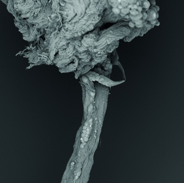 Eve Petit, dipl&ocirc;m&eacute;e de la ma&icirc;trise en g&eacute;nie chimique, a obtenu sa place de finaliste gr&acirc;ce &agrave; son image&nbsp;Nerf &agrave; vif.