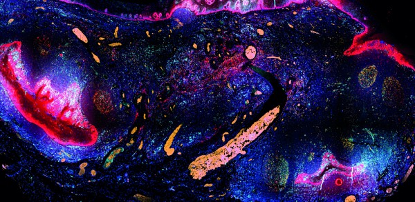 Celia Del Carmen Crespo Oliva, &eacute;tudiante &agrave; la ma&icirc;trise en immunologie, fait partie des finalistes gr&acirc;ce &agrave; son image&nbsp;D&eacute;peindre l'immunit&eacute;.