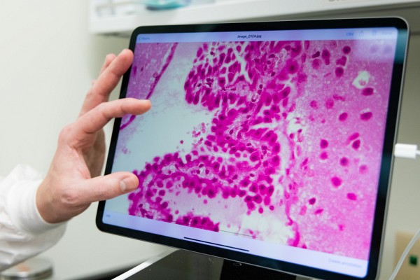 Notre cerveau baigne dans le liquide c&eacute;phalorachidien, qui en nourrit chaque r&eacute;gion. Selon les deux chercheurs, il serait la cl&eacute; du vieillissement.Photo : Mathieu Lanthier - UdeS