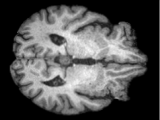 Image d'un cerveau (originale)